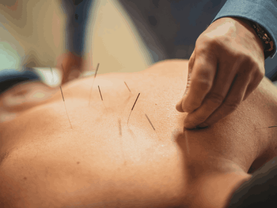 agopuntura schiena benessere